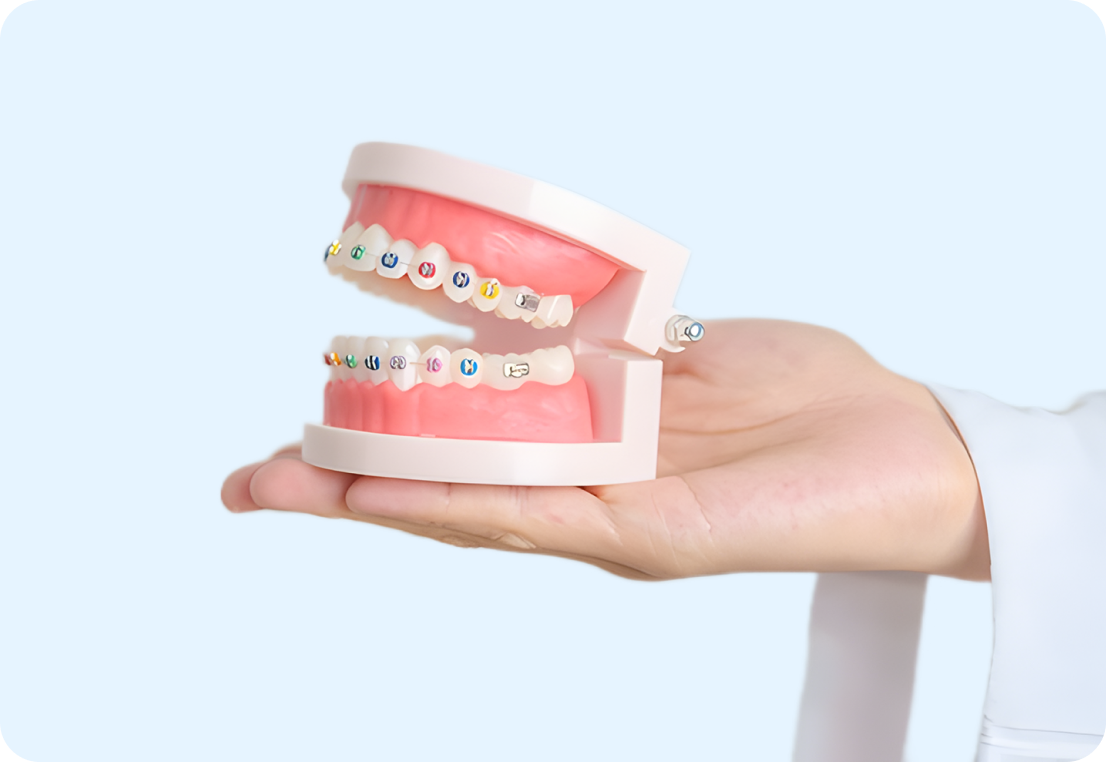 Braces Cost Breakdown: How Much Do Braces Cost in 2025?