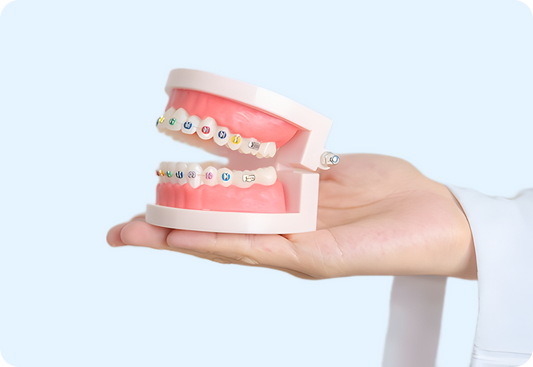 Braces Cost Breakdown: How Much Do Braces Cost in 2025?