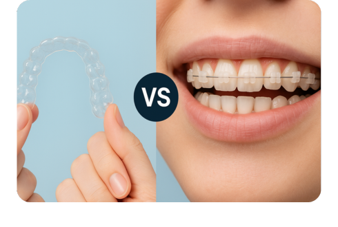 Ceramic vs. clear braces: What’s the actual difference?