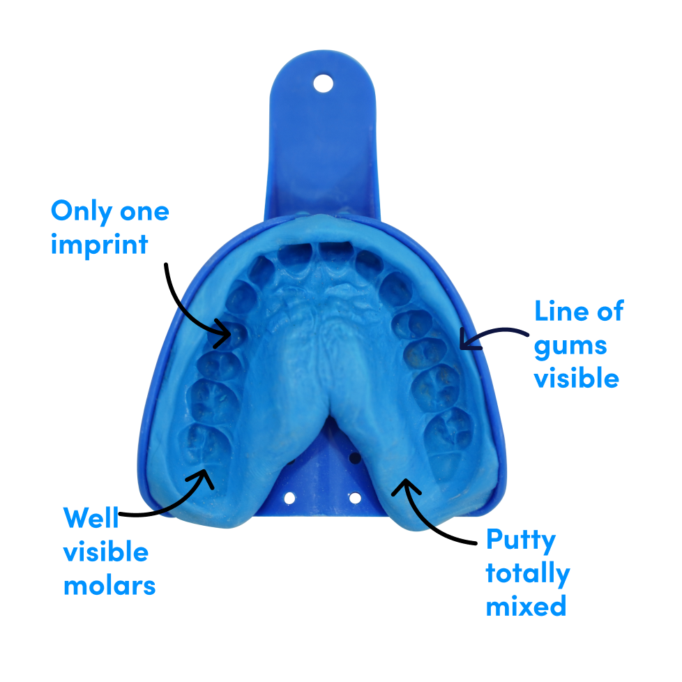 How to create precise dental impressions?