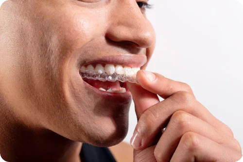 What’s the difference between a night guard and a retainer?