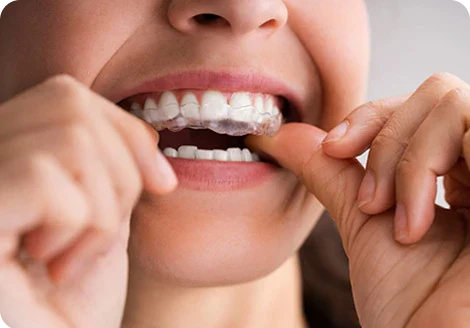 Can a custom night guard improve your sleep quality?