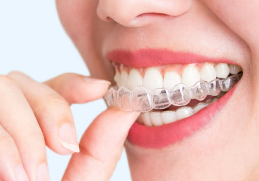 A woman wearing clear aligners
