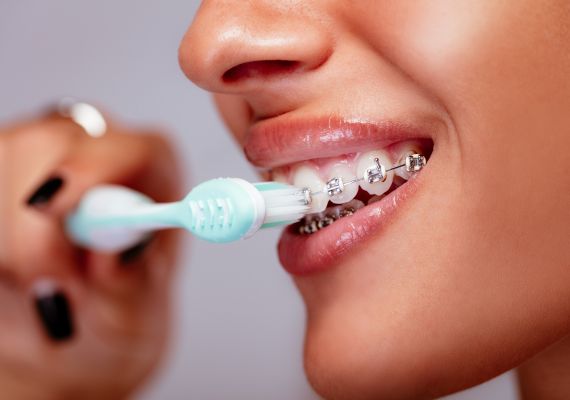 A woman brushing teeth while having braces on 