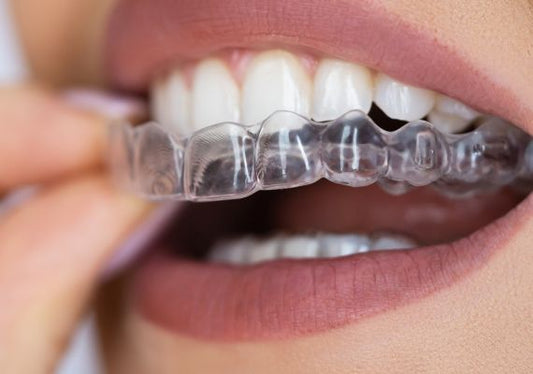 An image of someone sliding on clear aligners.