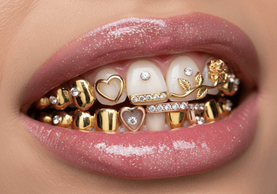 A man with dental grillz