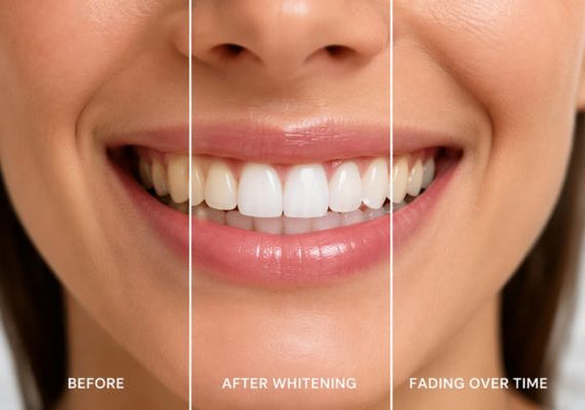 Split smile showing teeth whitening stages: before, bright white, and slight fading.