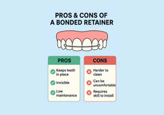 Pros and cons of bonded retainers