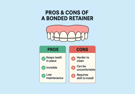 Pros and cons of bonded retainers