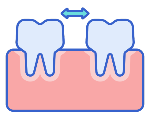 Diastema: Understanding the types of gap teeth and how to treat them