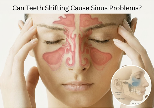  Image of a woman with sinus pain, showing the proximity of tooth roots to the maxillary sinus. 
