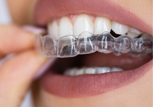 A close-up of a woman applying clear aligners