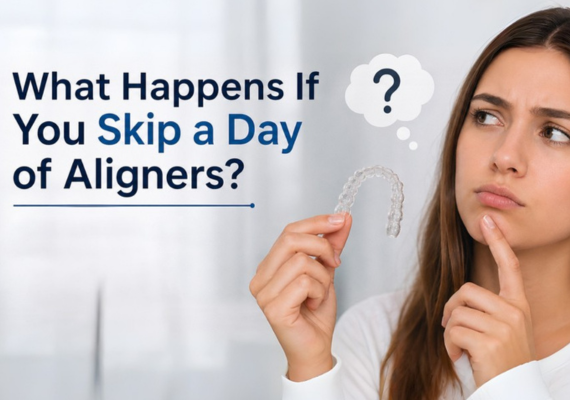 What Happens If You Skip a Day of Aligners?