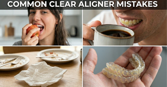 Image showing the mistakes to avoid during clear aligner treatments