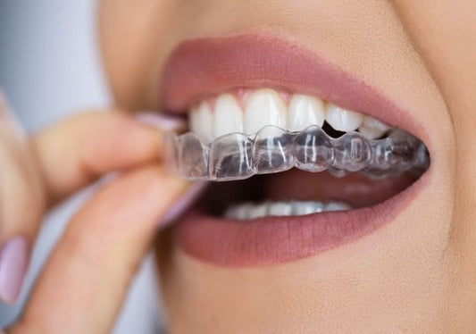 A girl applying clear aligners without a dentist.