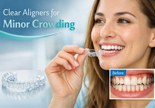 A smiling woman holding a clear aligner