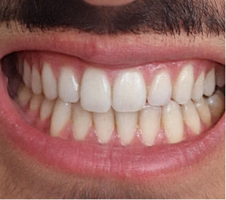 Treatment was top-notch!