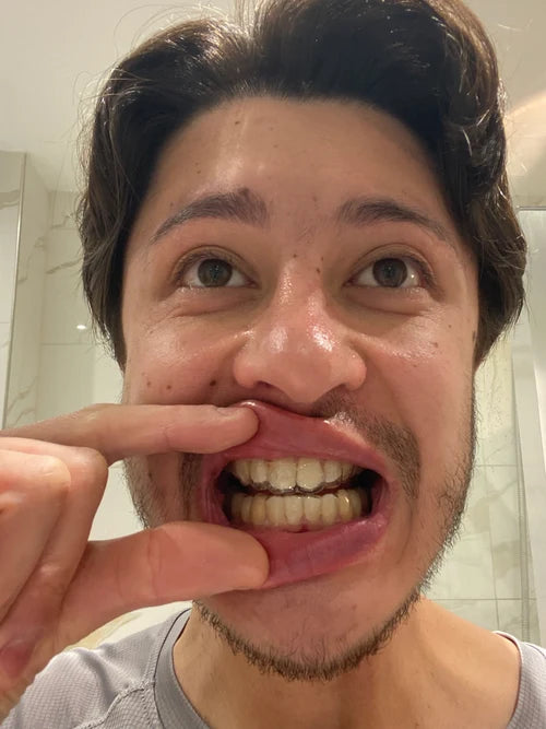 Very happy with my experience with Caspersmile!