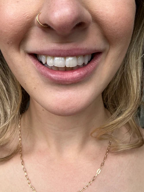 Really happy with the results!