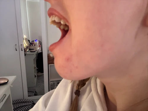 After treatment