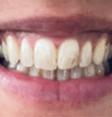 The results are amazing!