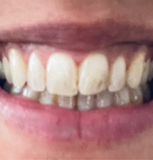 The results are amazing!
