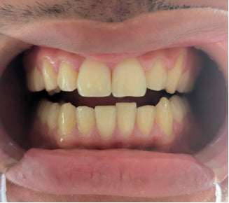 Perfect for quick fixes!