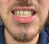 Really happy with the results!