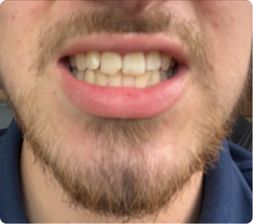 Before treatment