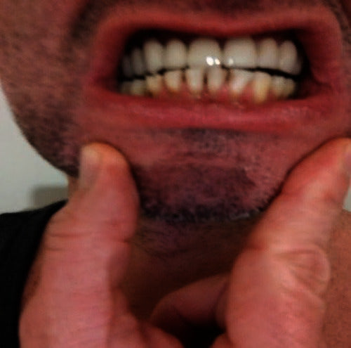 After treatment