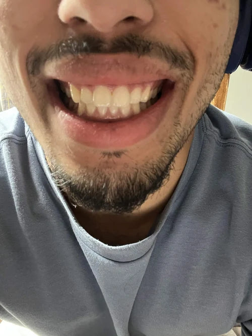 World-class experience from Caspersmile!