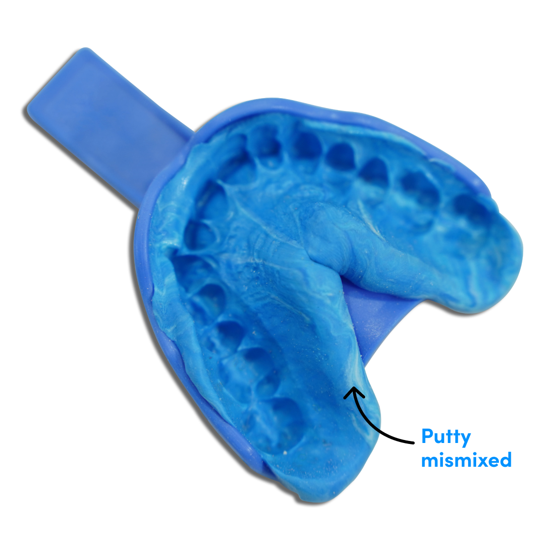 A) An example of moulded and hardened dental putty in the shape of the