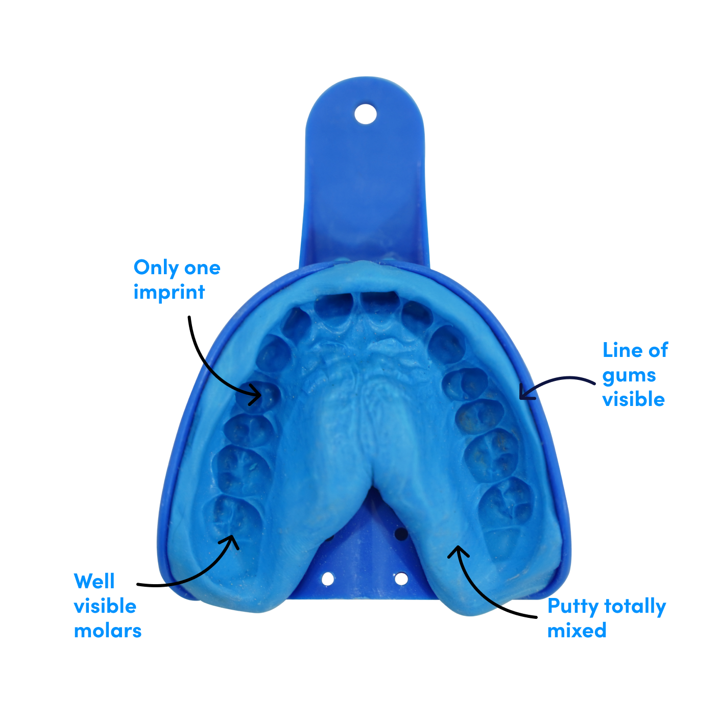 Exquisite Can Dental Impressions Pull Teeth Out Moment for Your Screen Exquisite Can Dental Impressions Pull Teeth Out Moment for Your Screen