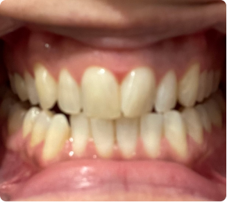 The results are amazing!