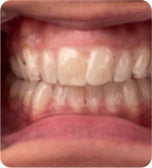 Before treatment