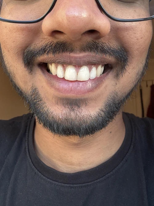 After treatment