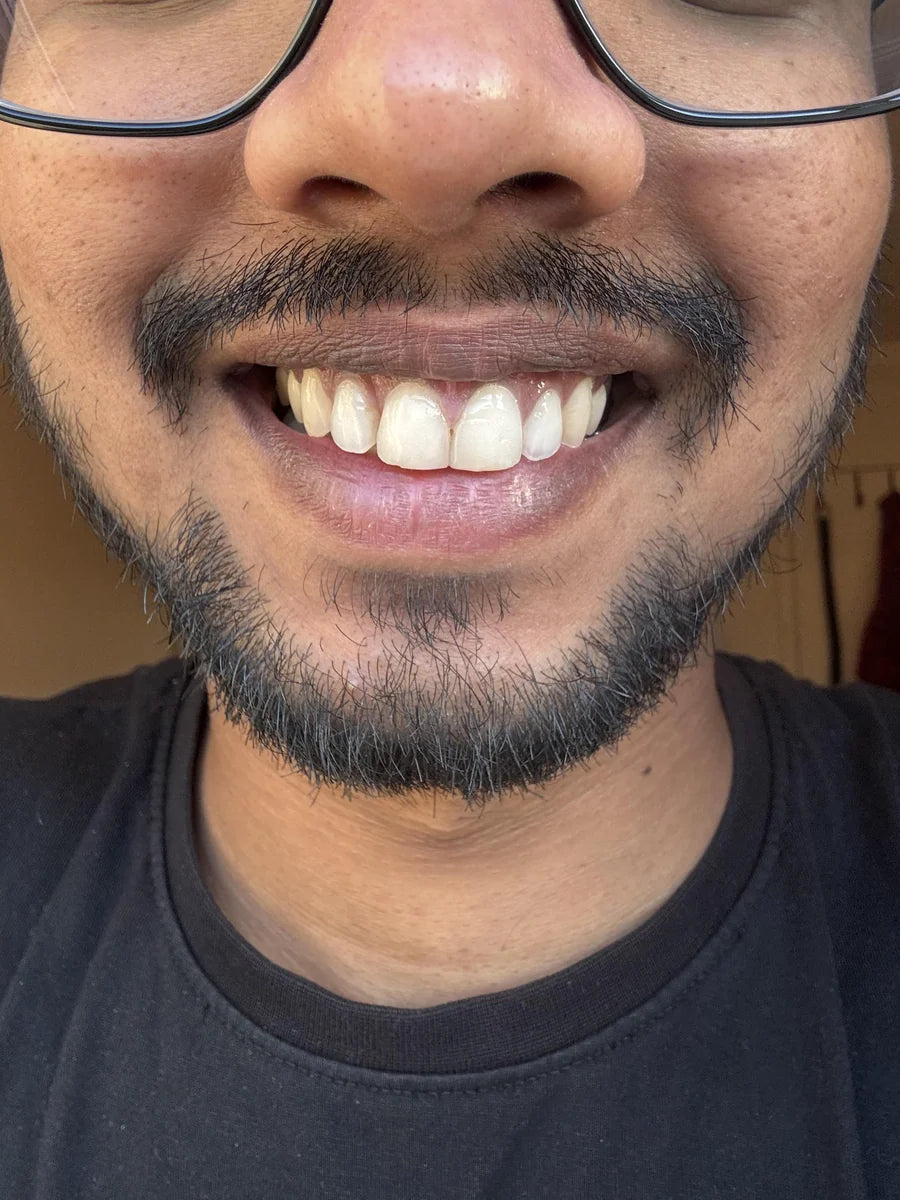 Really happy with the results!
