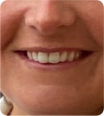 My smile looks amazing!