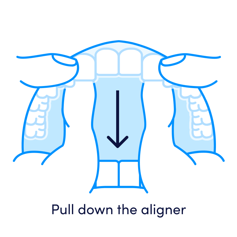 How to remove clear aligners-4