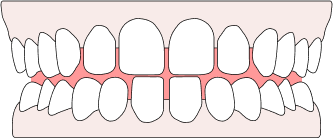 Edge to Edge – Caspersmile