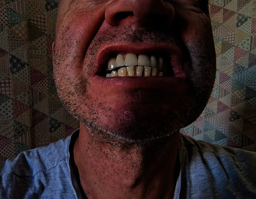 Before treatment