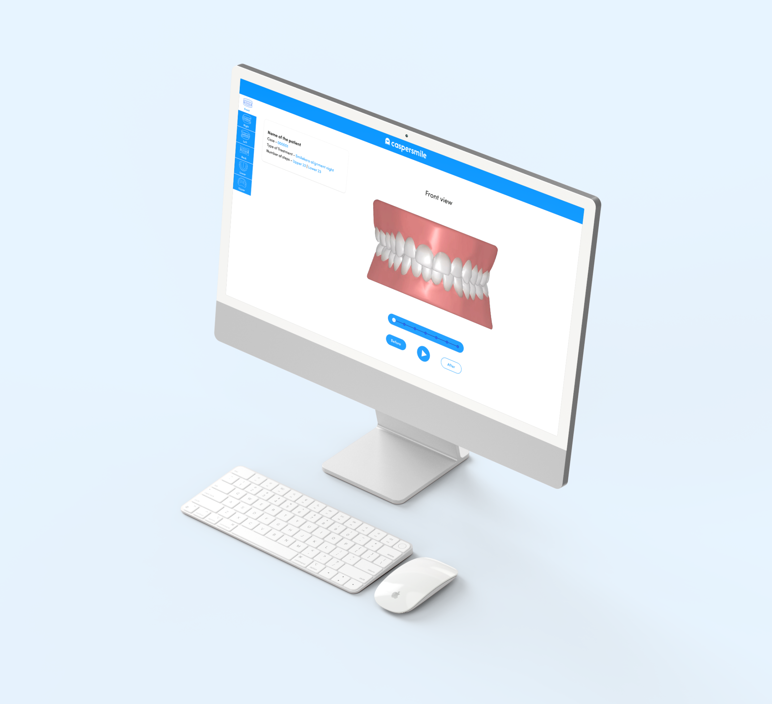 Got misaligned teeth? <br>We have the solution!